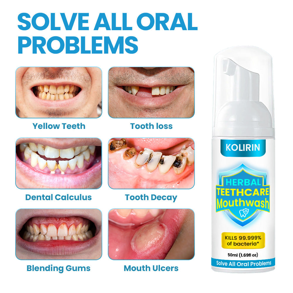 🎉 2025 Limited 70% OFF ️🔥 HERBAL TEETHCare Kolirin Mouthwash - Solve all Oral Problems