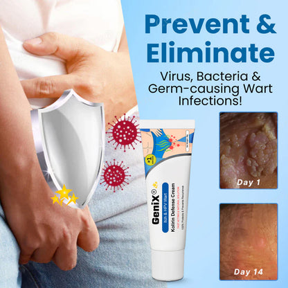 2025 Upgrade GeniX® Itch & HPV Wart Kolirin Defense Cream